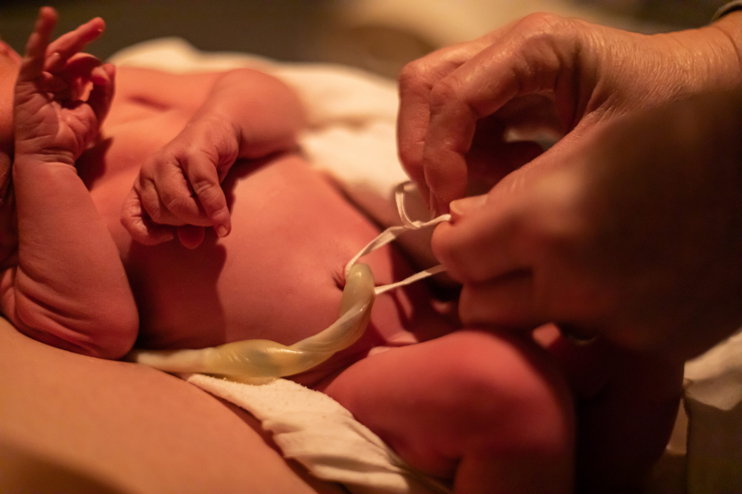 Coto umbilical: principais cuidados e sinais de alerta