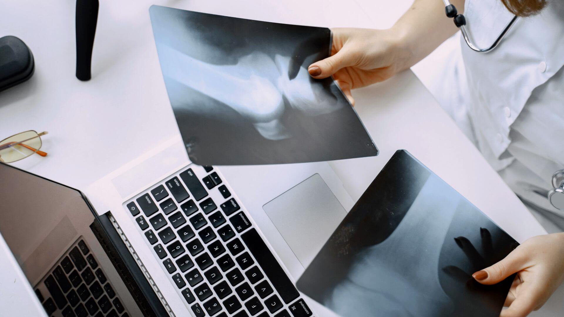 O que é a osteoporose e como se prevenir?