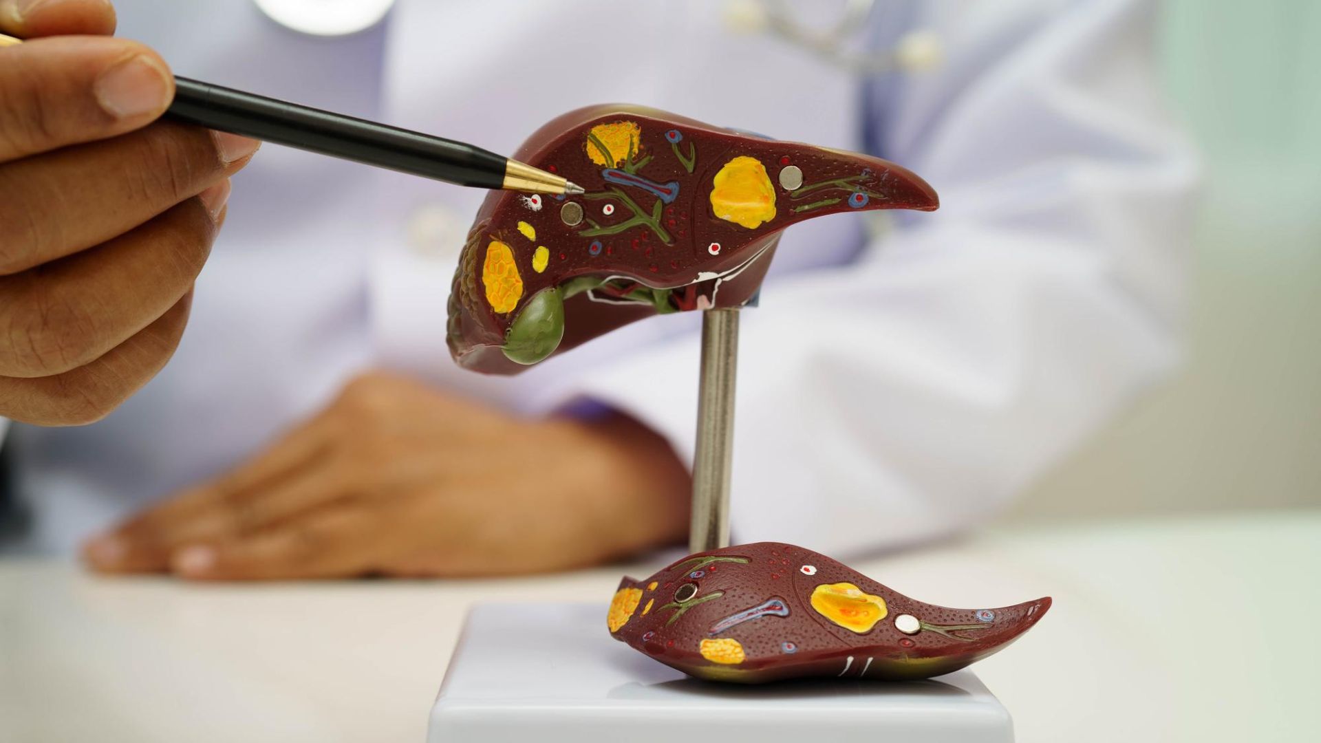Novas definições da doença hepática esteatótica metabólica