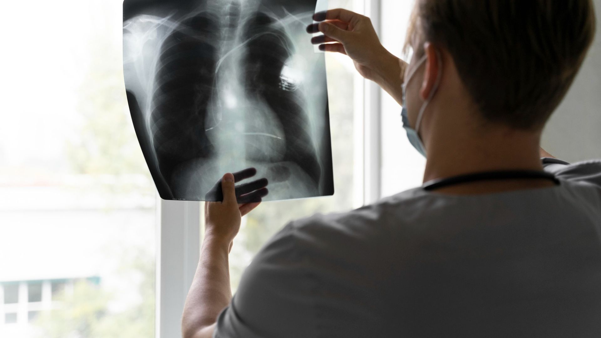 Conheça as vantagens da pesquisa do IGRA-QuantiFERON para a tuberculose