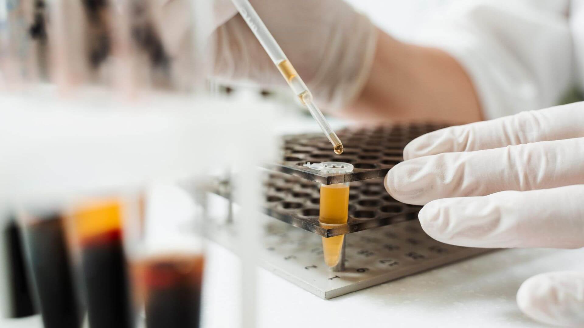 Biópsia líquida: pesquisa de mutação EGFR no plasma