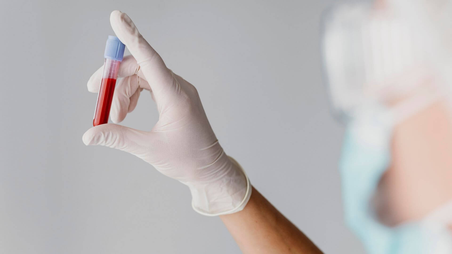 Utilidade clínica da hematopoiese clonal de significado indeterminado