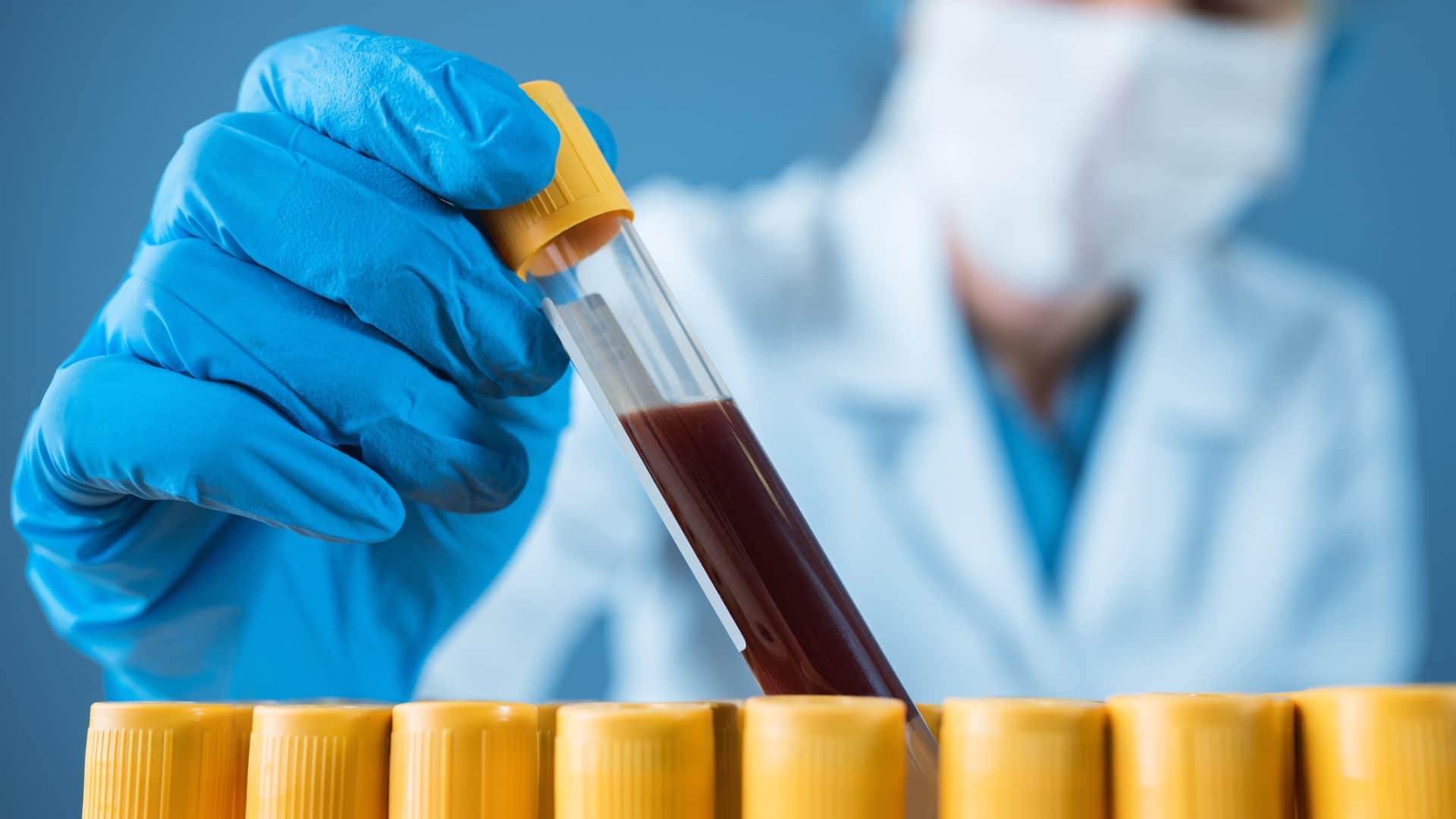 Exames hematológicos: você sabe o que eles avaliam e quais são os principais?
