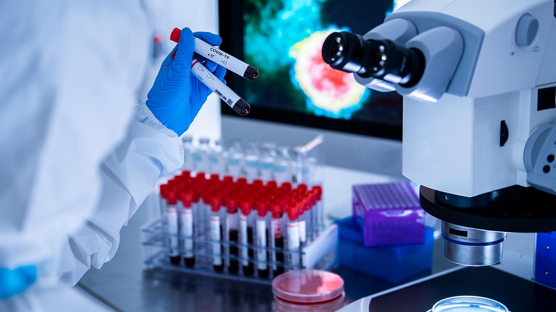Teste de Anticorpos Neutralizantes: descubra como funciona e para que serve