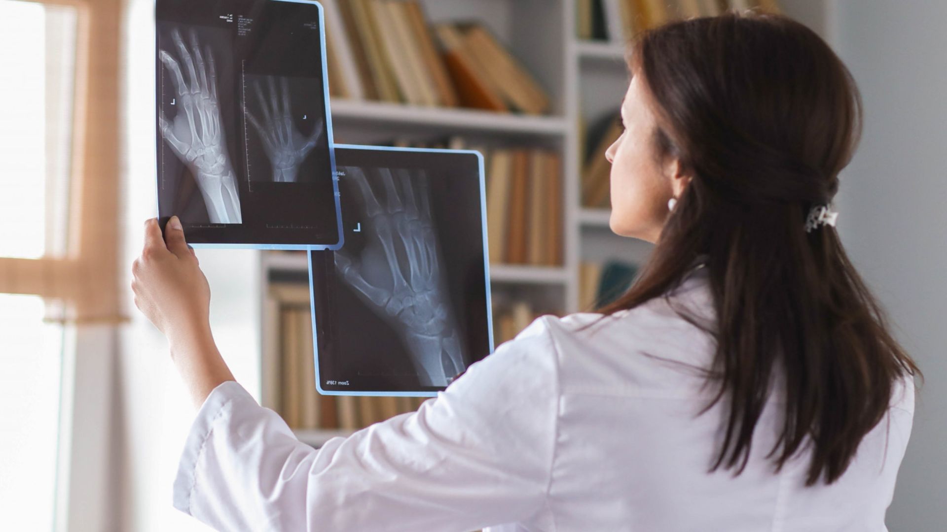 Investigação laboratorial e clínica da osteoporose