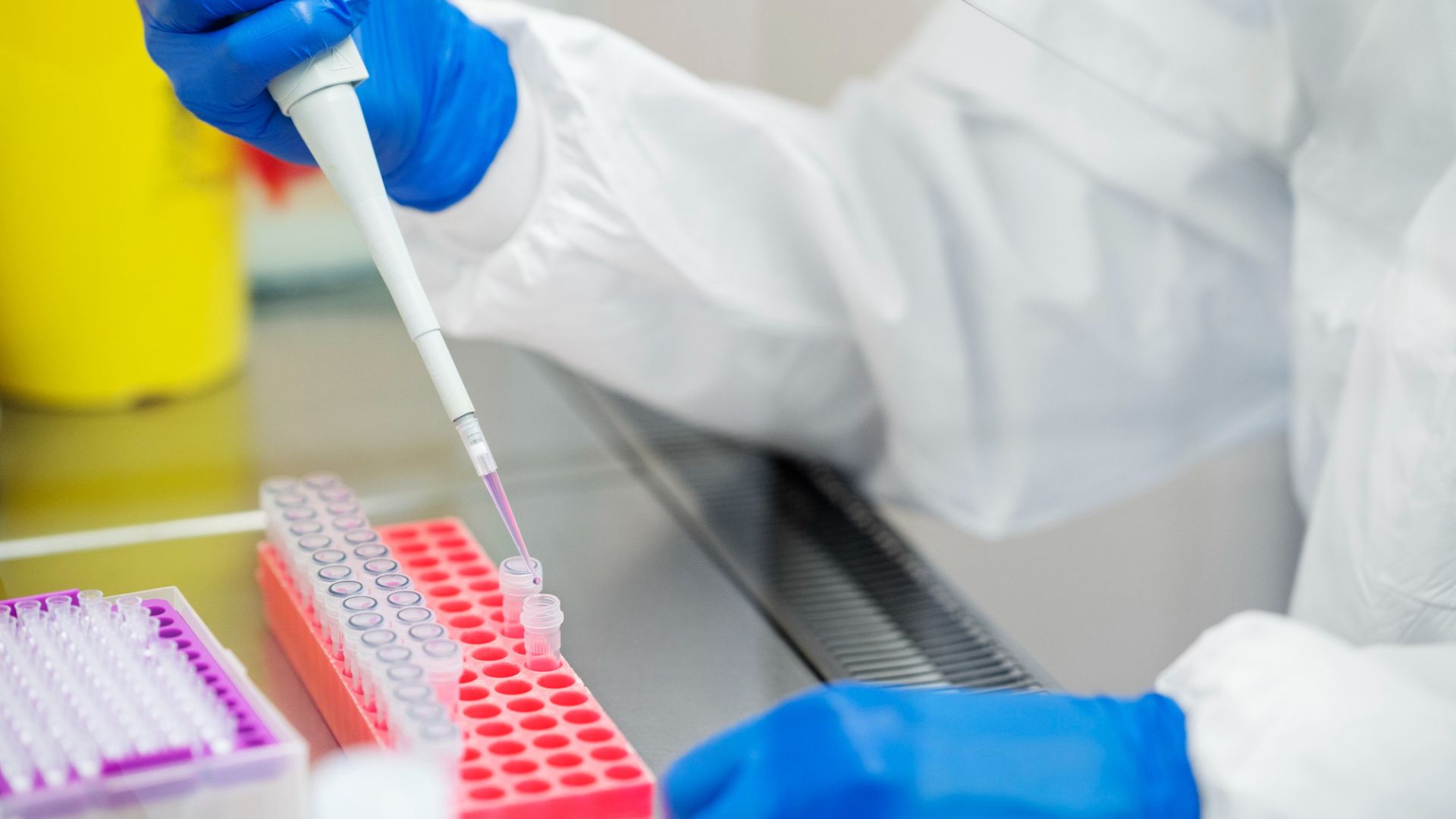 Conheça a utilidade da investigação molecular no diagnóstico de ISTs