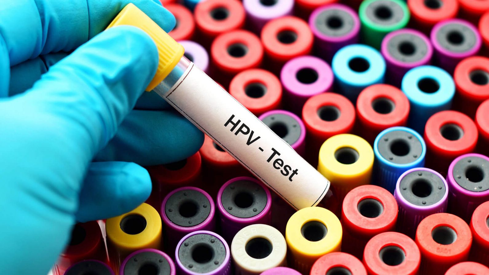 O que você precisa saber sobre HPV: sintomas, tratamento e prevenção