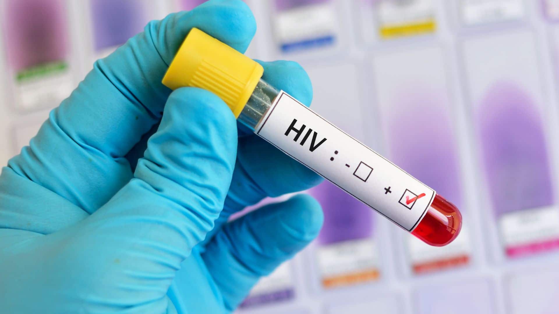 HIV não é sinônimo de aids e tratamento pode garantir vida normal a  pacientes