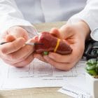 hepatite