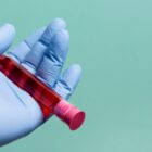 Detecção de anticorpos anticélula (FAN)