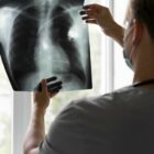 Teste IGRA-QuantiFERON no diagnóstico da tuberculose