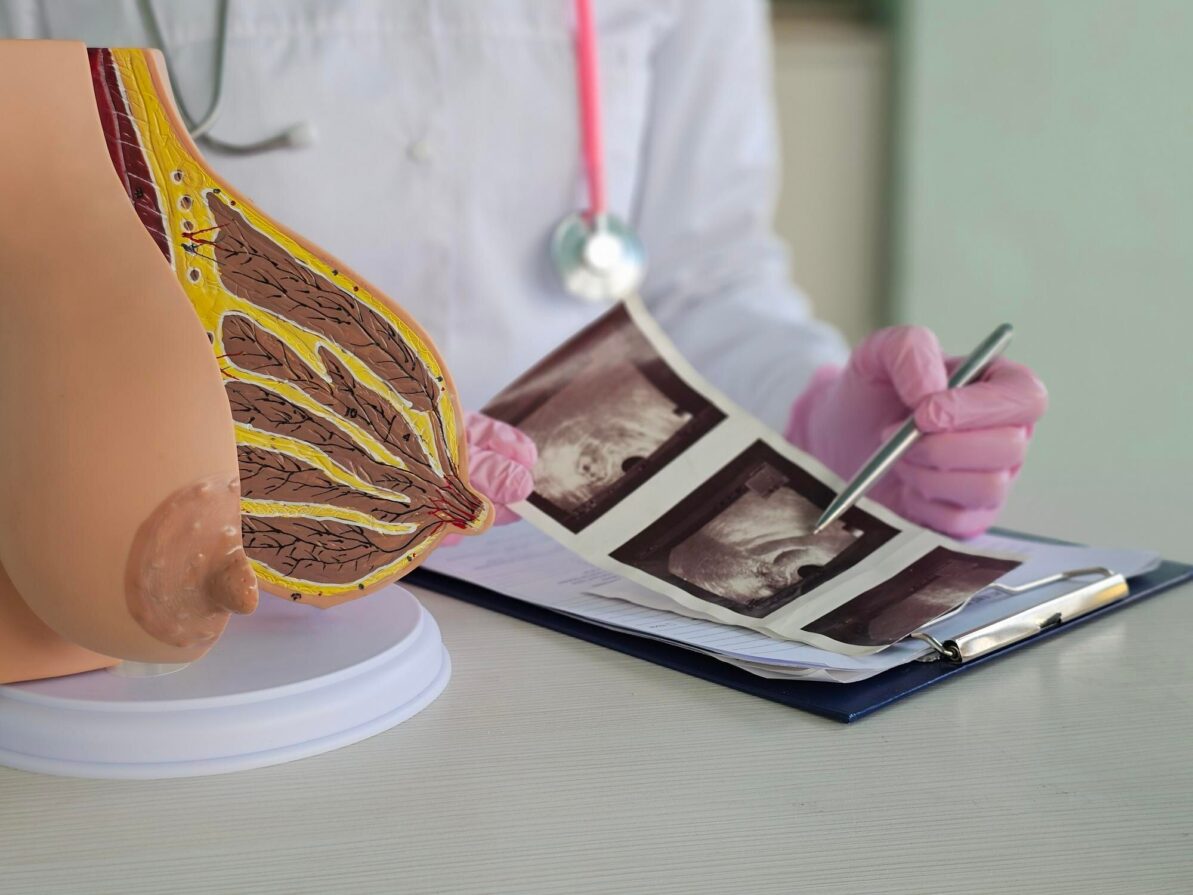 Mamas densas: quando indicar exames complementares?