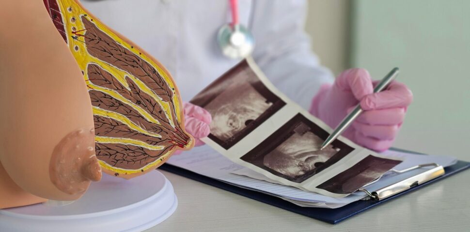 Mama densa e exames complementares