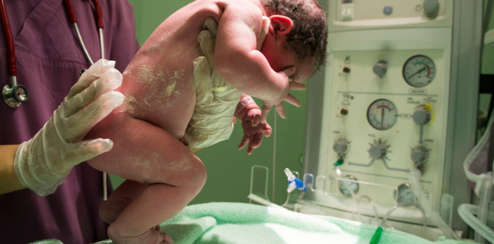 Triagem neonatal para SCID e agamaglobulinemia congênita